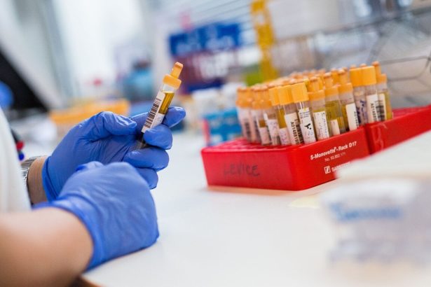 Vysoko infekcna choroba sa siri Lucencom