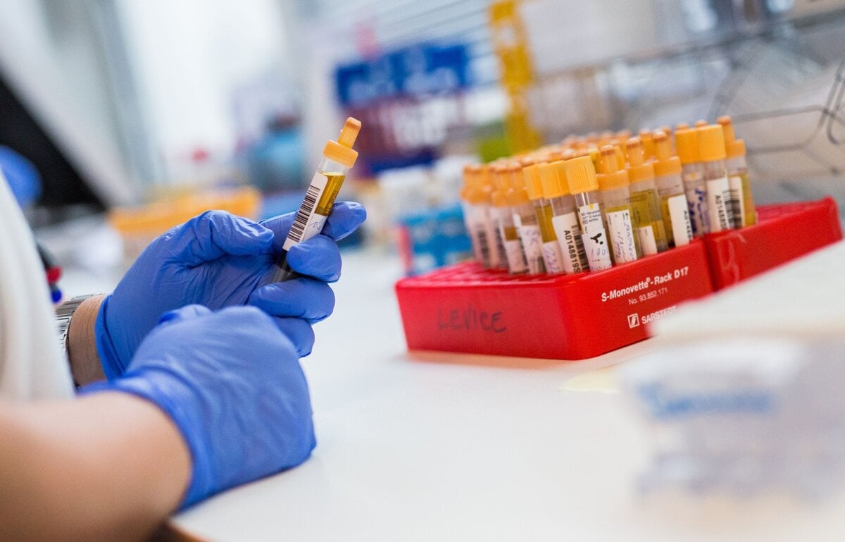 Vysoko infekcna choroba sa siri Lucencom