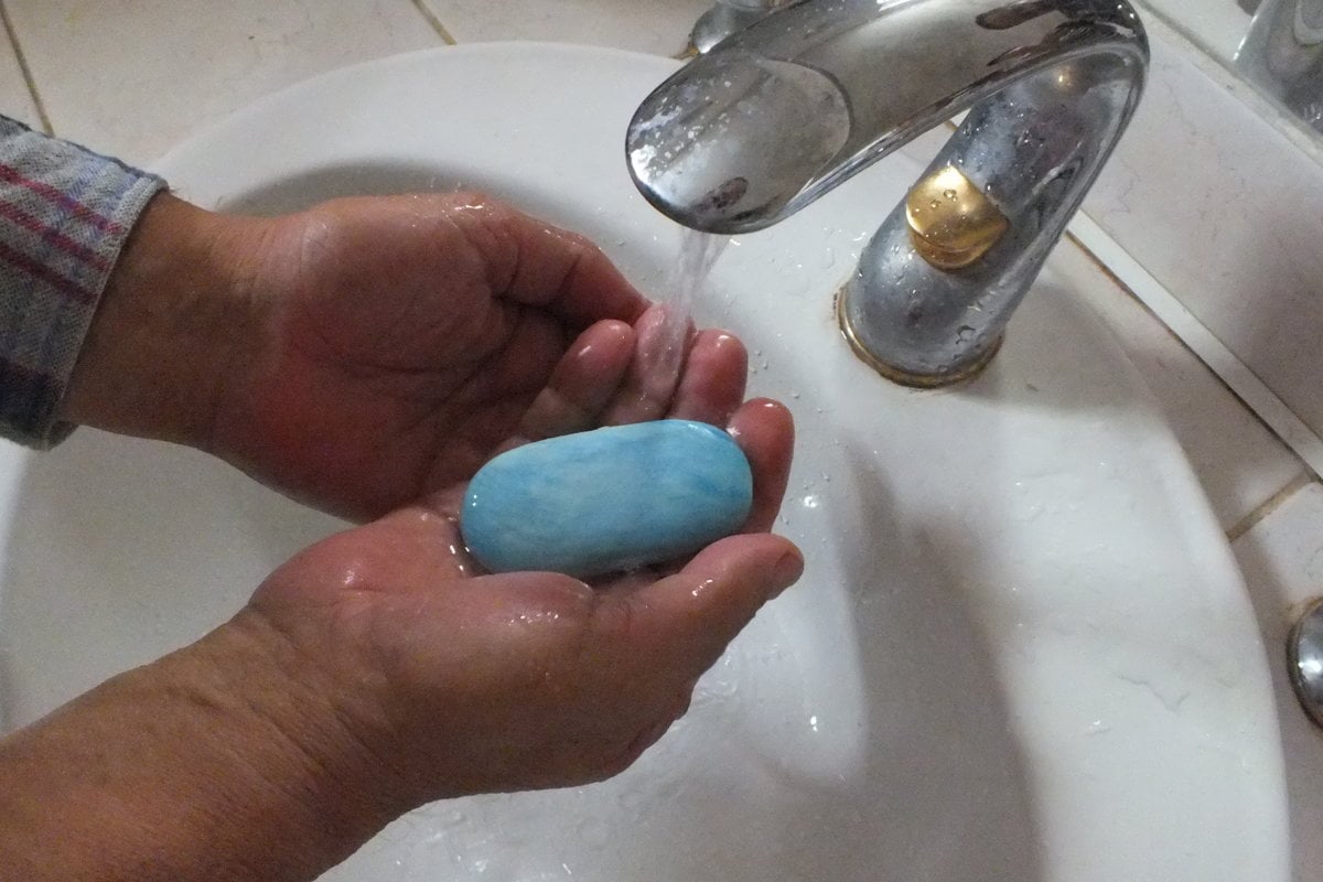 Hygienici v okresoch Presov a Sabinov neeviduju aktivne ohniska zltacky