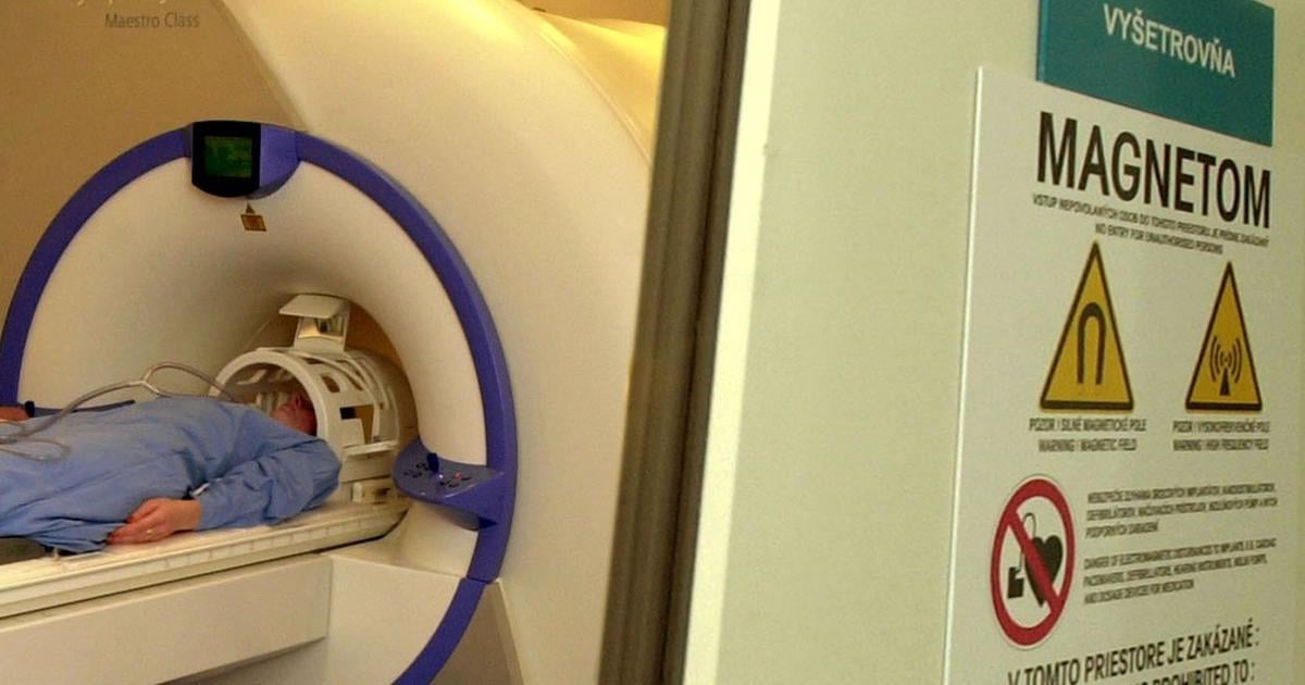rokovania m medzi douverou a spolocnostou pro diagnostic group nadalj prebiehaju