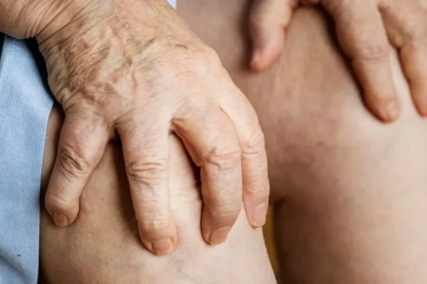 Osteoporóza sa môže dlho vyvíjať bez príznakov.